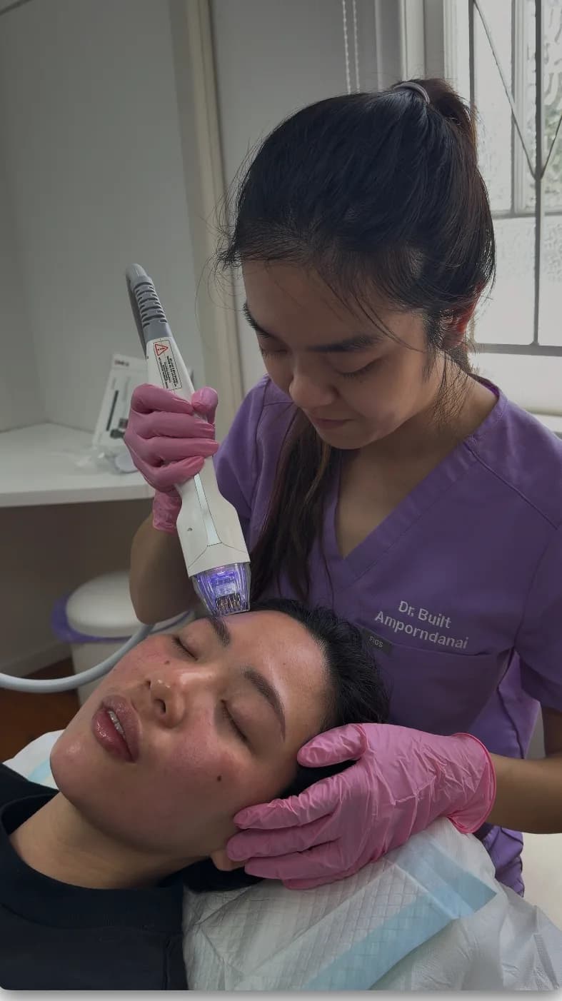 Close detail of the Virtue RF handpiece being guided across a client's cheek during treatment